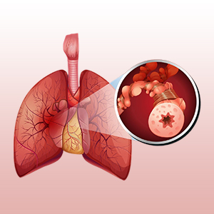 COPD treatment in Vijayawada