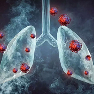 Lung malignancies