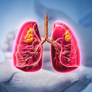 Interstitial lung disease