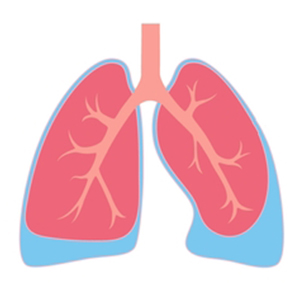 Pleural effusion