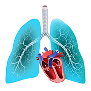 Pulmonary artery hypertension